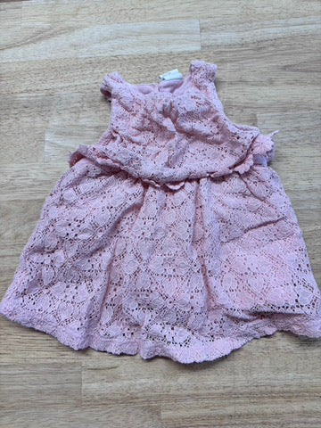 H&M Pink Lace Overlay Dress 1–2M